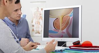 prostatitisa diagnostikatzea gizon batean