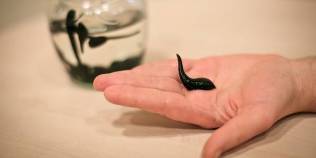 tratamendua leeches